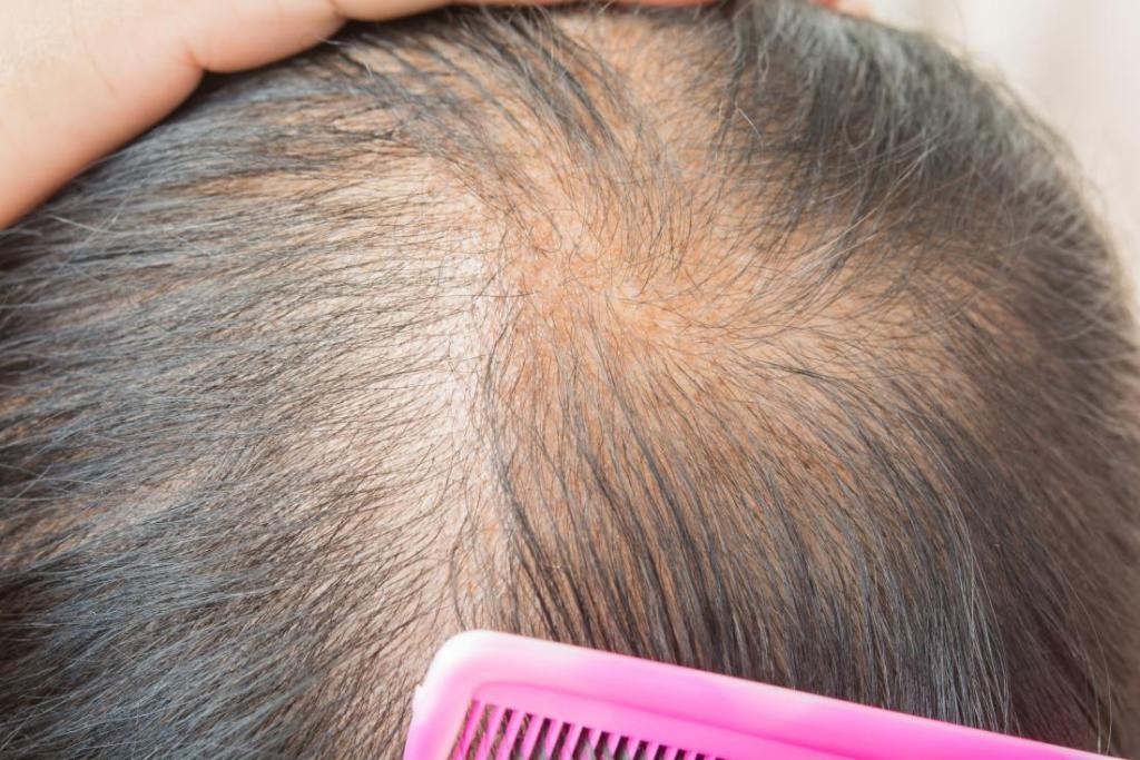 Best Hair Products for Thinning Hair